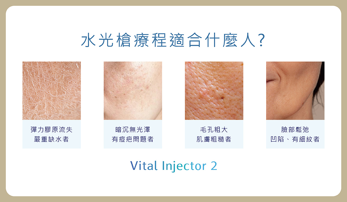https://sy-bac.demo1.app/wp-content/uploads/2026/05/03_aesthetic-medicine_B_skinbooster_introduce_3.jpg