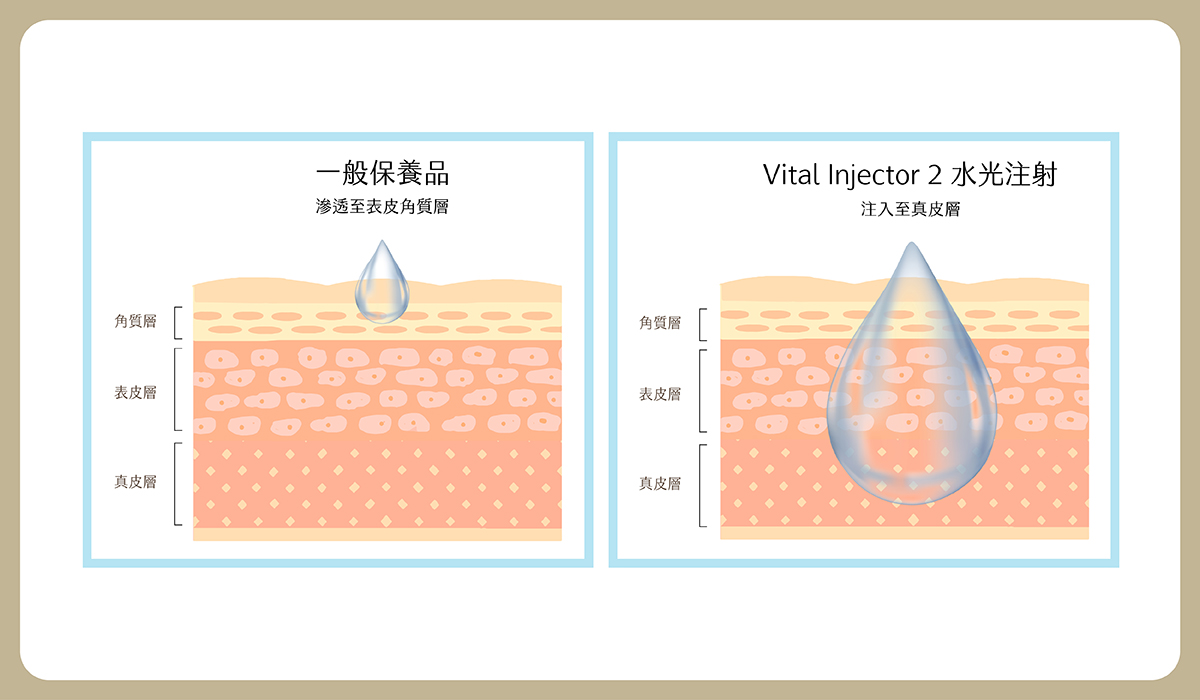 https://sy-bac.demo1.app/wp-content/uploads/2026/05/03_aesthetic-medicine_B_skinbooster_introduce_4.jpg
