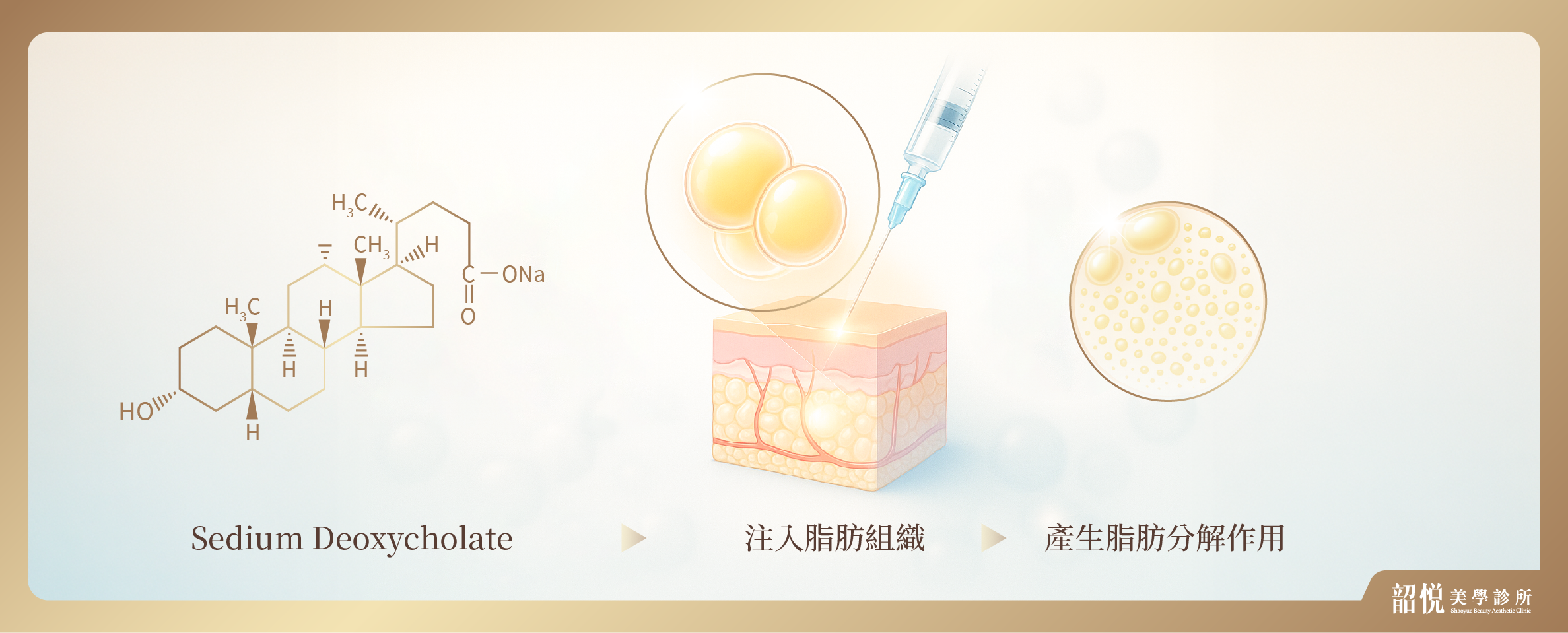 微針溶脂療程|不是胖,是線條被藏住了