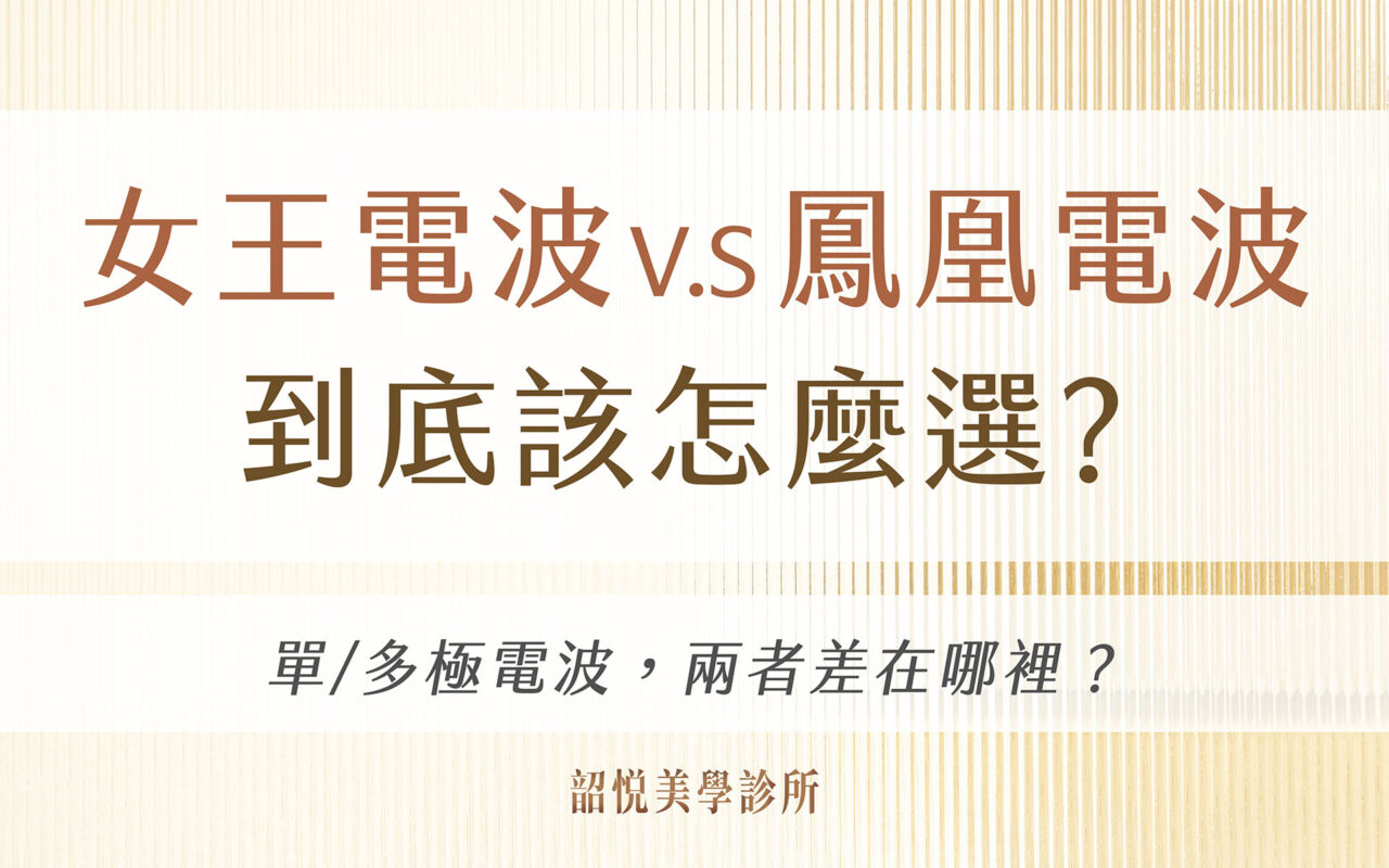電波百百種！到底怎麼選？ 女王電波 V.S 鳳凰電波
