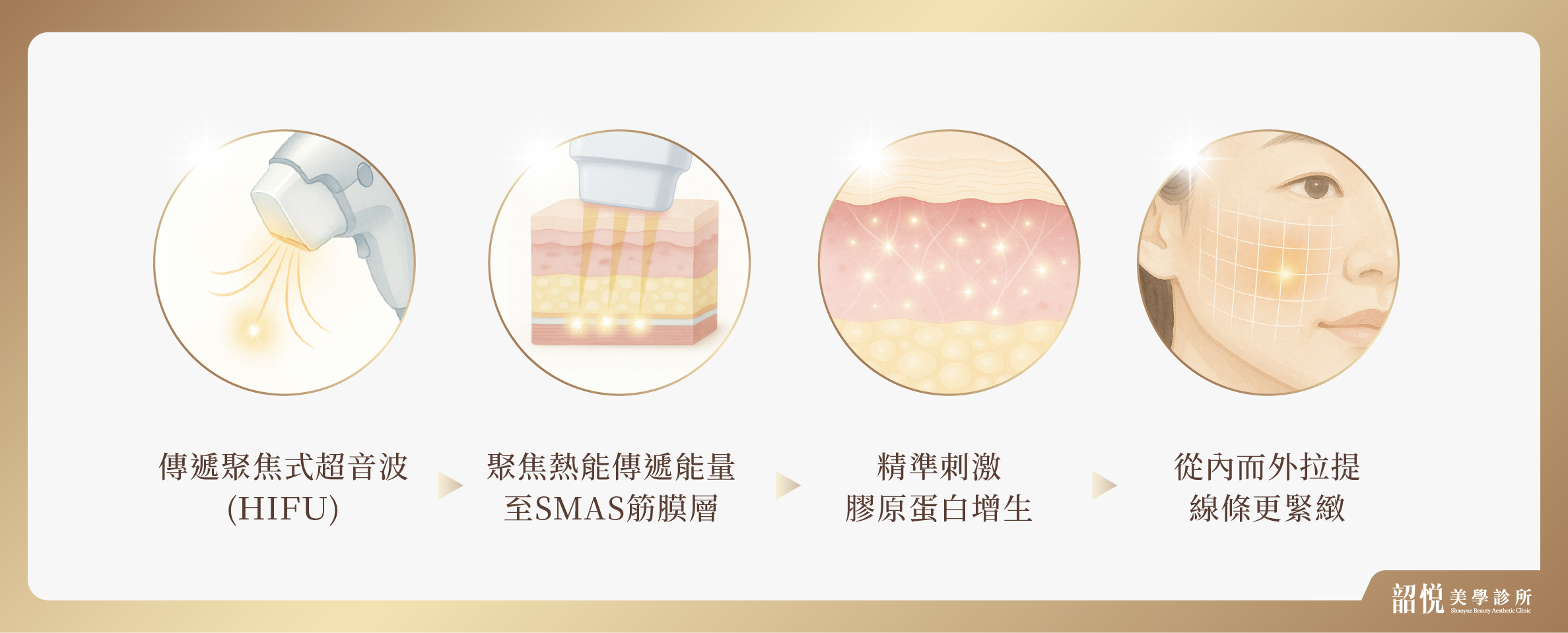 電波緊緻|告別鬆弛老,留住膠原蛋白